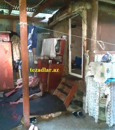 İsmayıllı sakininin ACINACAQLI DURUMU... - Başçıdan MƏDƏT UMURLAR...