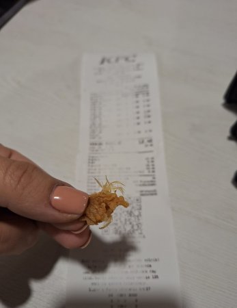 `KFC` toyuğu təbii halda - tüklü-tüklü satır - BU NƏDİ BELƏ?!