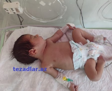 “Yeni Gəncə Tibb Mərkəzi”ndə KÖHNƏ OVQAT... - İTTİHAM VAR...