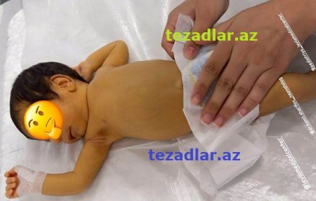 “Yeni Gəncə Tibb Mərkəzi”ndə KÖHNƏ OVQAT... - İTTİHAM VAR...