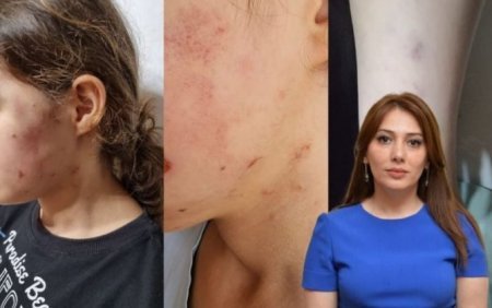 Məktəbli qıza zorakılıq edən vəzifəli şəxs bələdiyyə seçkilərində namizəd oldu