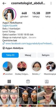 Lisenziyasız kosmetoloji fəalliyyət göstərən Aygün Abdullayeva…. Nə sertifikat kimsən sən?!!!!!-Araşdırma-Fotolar