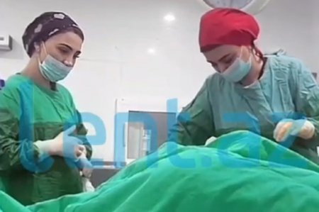 Cərrah Təbəssüm Qurbanovanın lisenziyası ləğv edildi - Əməliyyat zamanı canlı açmışdı
