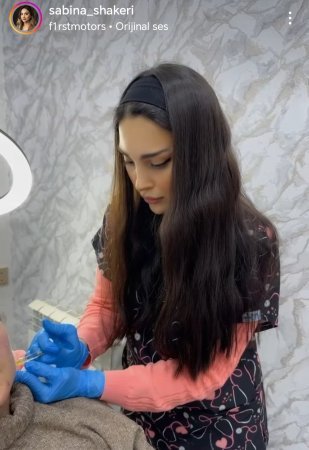 “SAY” Estetik Mərkəzində tibbi təhsili olmayan həkim-kosmetoloq aşkar olundu–FOTOLAR