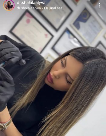 Tibbi təhsili olmayan kosmetoloq Şəlalə Əliyeva necə inyeksion prosedurlar həyata keçirir?