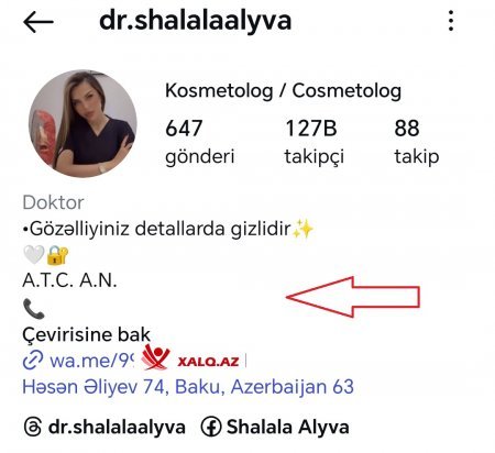 Tibbi təhsili olmayan kosmetoloq Şəlalə Əliyeva necə inyeksion prosedurlar həyata keçirir?