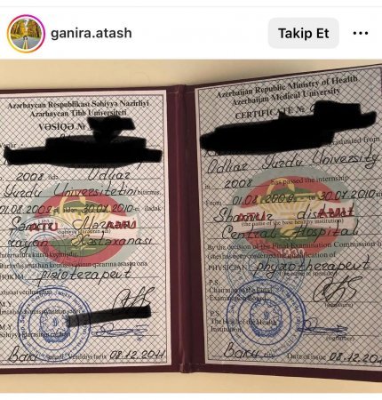 Daha bir “saxta” həkim qalmaqalı – Rəhimə Atəş necə fizioterapevt olub?
