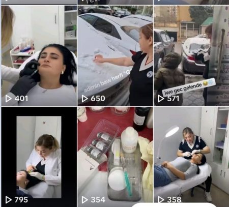 Saxta kosmetoloq qadını bu kökə saldı – FOTO/VİDEO